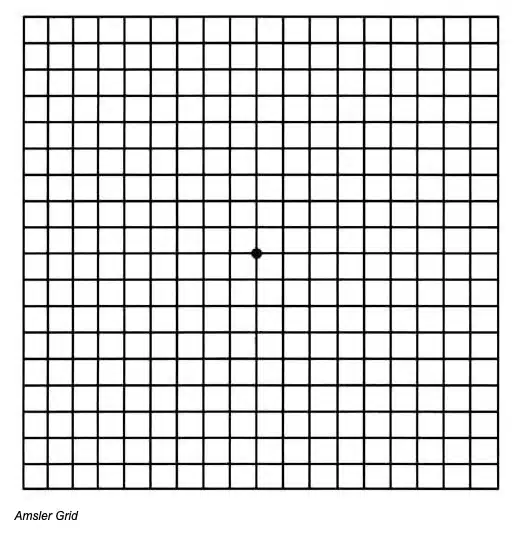 Amsler grid with evenly spaced black lines and a central fixation dot used to monitor central vision changes.