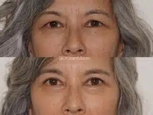 Two vertically stacked close-up portraits of a woman with gray hair.