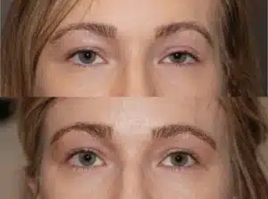 Before-and-after close-up of eyes and eyebrows; top shows thin, light brows with a sleepy look, bottom shows fuller, defined brows with a more awake look.