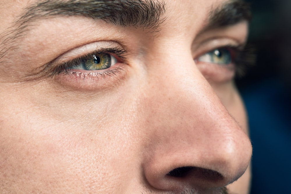 Up close headshot of green eyes after LASIK