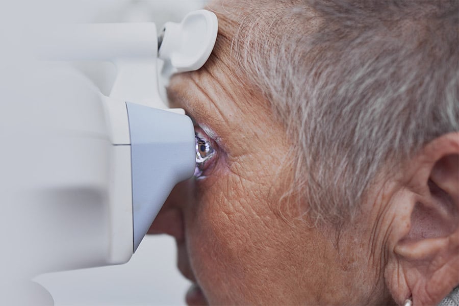 Glaucoma Pre surgery patient