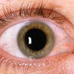 Discovering-Dry-Eye-Symptoms