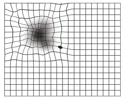 What someone with AMD can see wavey line and black spots.