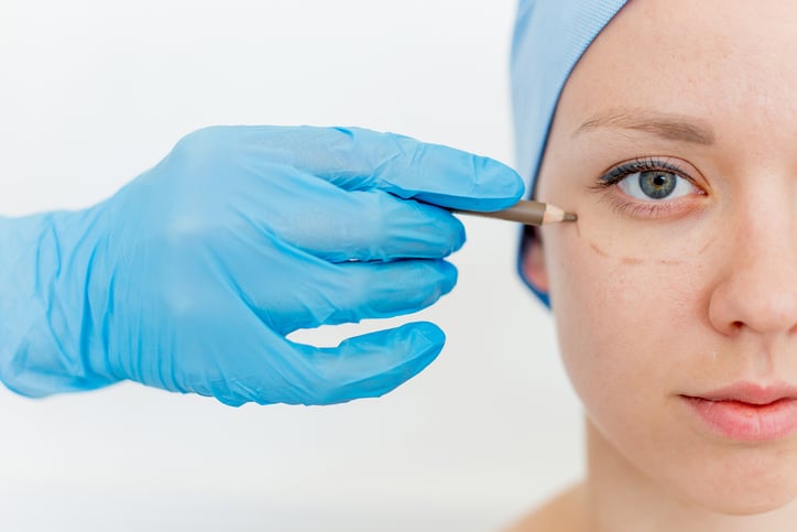 what does an oculoplastic surgeon do - Surgeon marking under the eyelid to illustrate what does an oculoplastic surgeon do during preoperative planning.