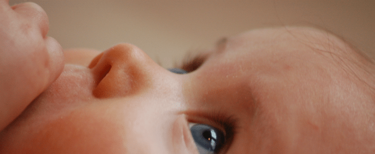 Baby with genetic eye conditions