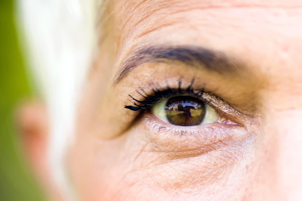Close-up of an older eye showing age-related vitreous changes linked to eye floaters.