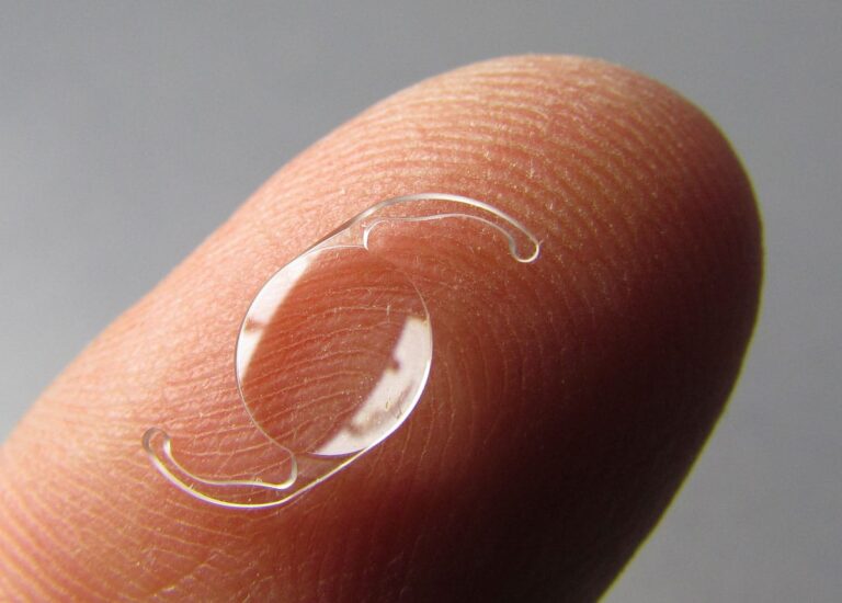IOL lens implant on finger that is used at Barnet Dulaney Perkins