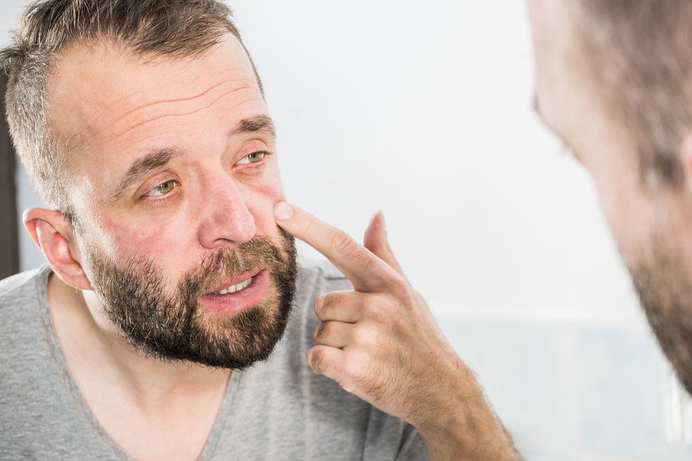 Man examining redness and irritation around his eye while seeking emergency eye care.