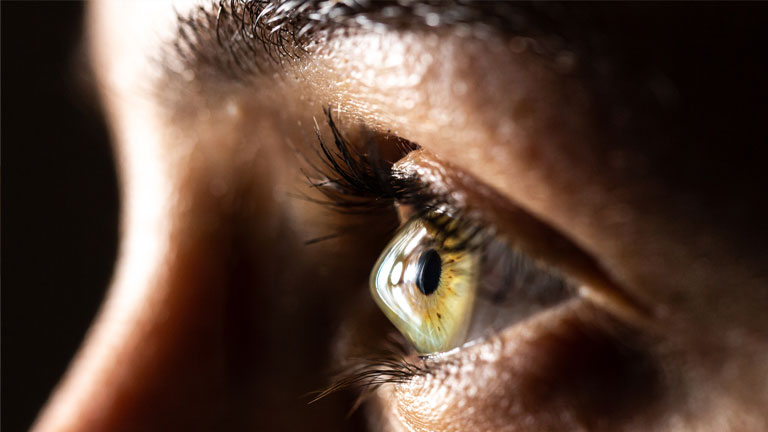 Macro of a clear female eye with keratoconus stock photo