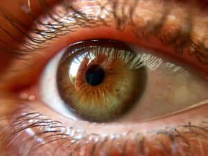 Close-up of an eye illustrating why you keep seeing spots due to floaters